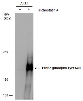 Her2 / ErbB2 (phospho Tyr1139) antibody